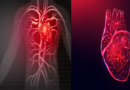Differentiating Heart Attack, Cardiac Arrest, and Heart Failure: